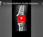 Dr. Garcia Performs Double Osteotomy Procedure