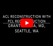 Dr. Garcia’s technique for Combined ACL and PCL reconstruction