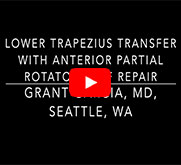 Lower Trapezius Transfer with Partial Cuff Repair